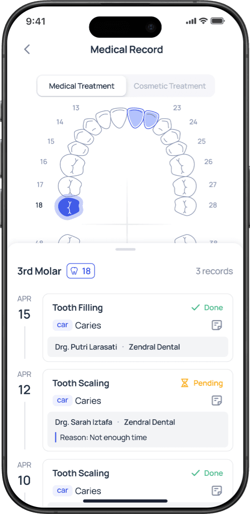 Phone App UI 4
